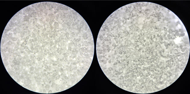 microencapsulation-in-functional-nutrition-6.jpg microencapsulation-in-functional-nutrition-6.jpg